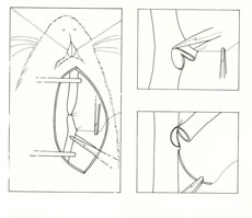 practicas de microcirugia