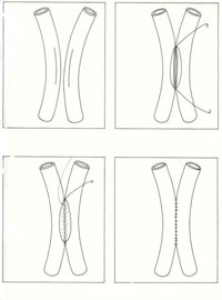 practicas de microcirugia