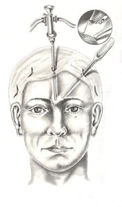 practicas de cirugia endoscopica