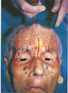 practicas de cirugia endoscopica