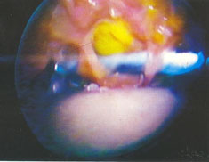practicas de cirugia endoscopica